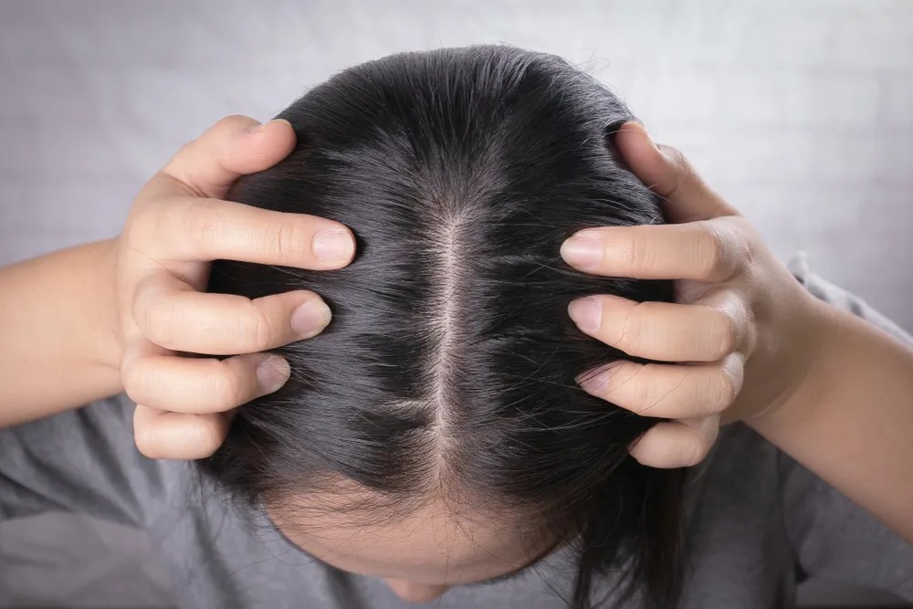 Cara Menghilangkan Kutu di Rambut Secara Alami • Hello Sehat