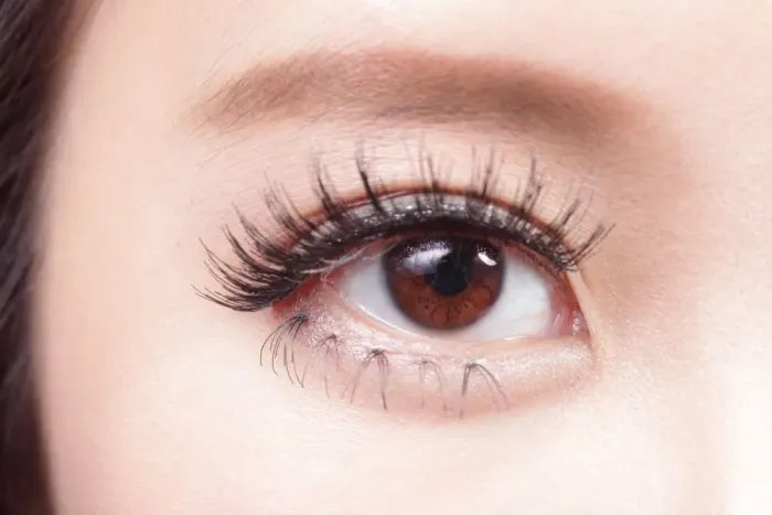 Tanda-Tanda Munculnya Freckles Di Mata Plus Penyebabnya
