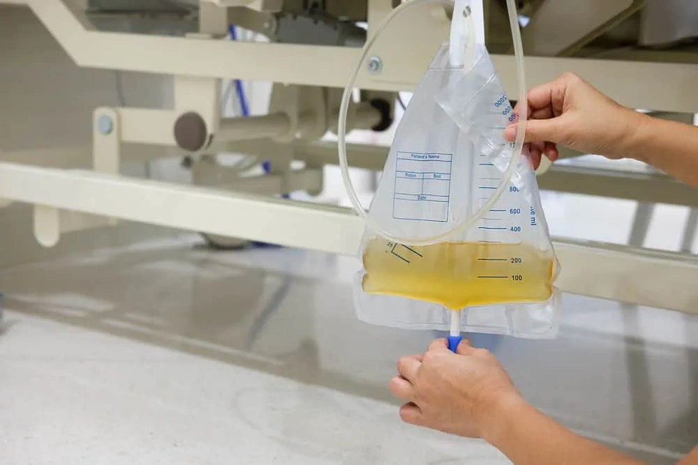 Pemasangan Kateter Urine, Bagaimana Prosesnya?
