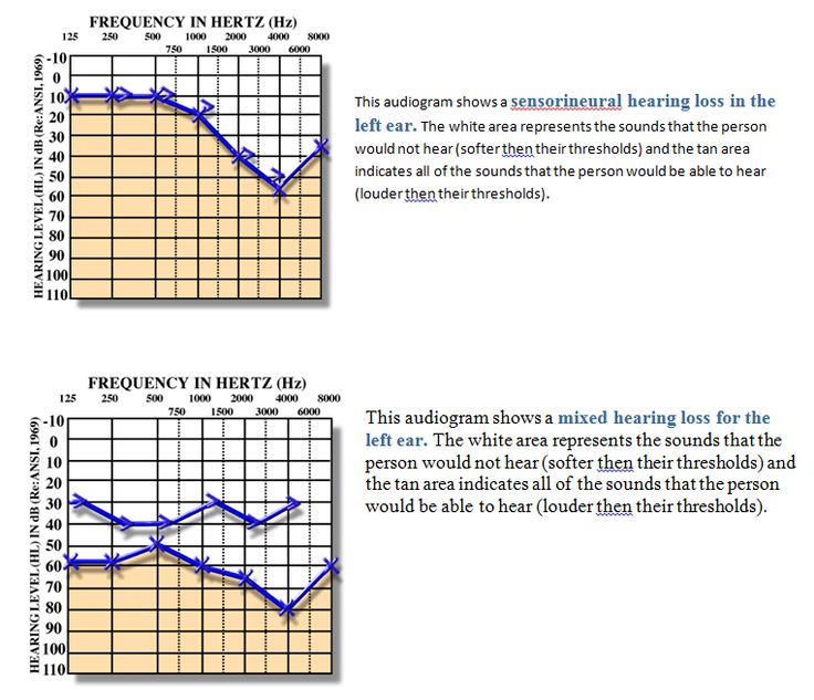 What You Need To Know About Determining Hearing Test Thresholds Home