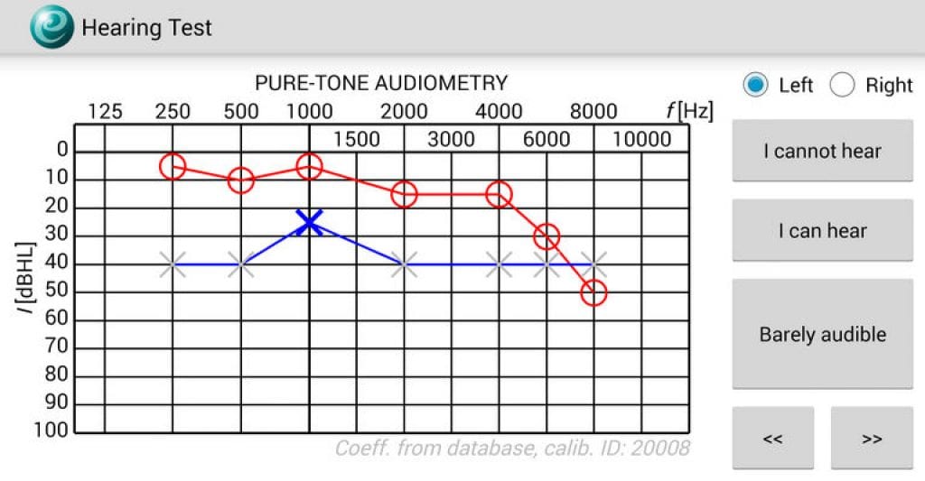 Cost Of Hearing Tests In British Columbia Canada What To Expect And