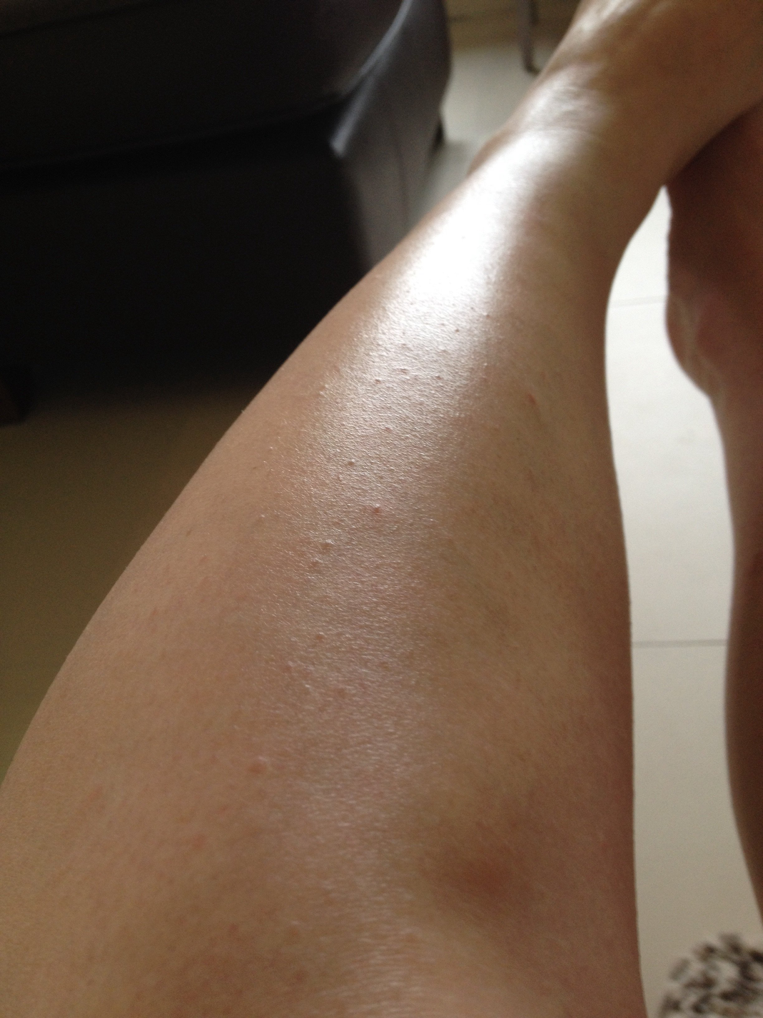 Lumps and bumps on legs after waxing SalonGeek