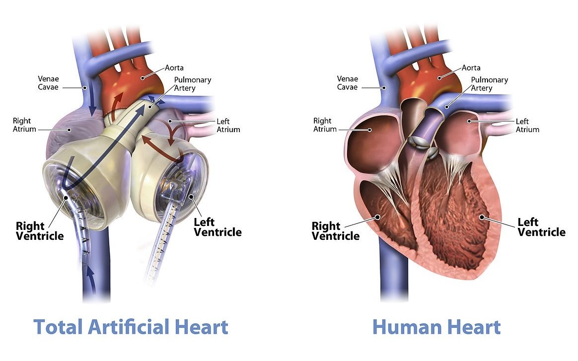 Cuore (bio)artificiale totale un nuovo per la medicina