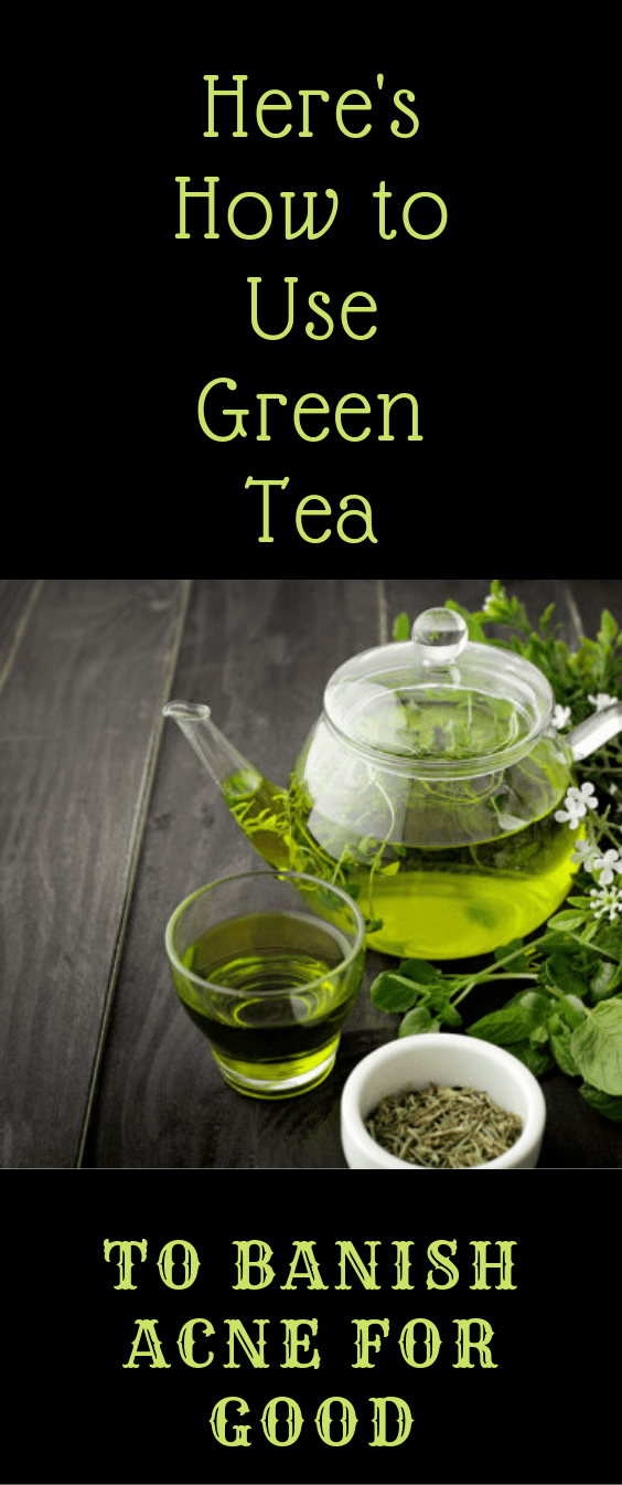 Does Green Tea Cure Acne Just Tea