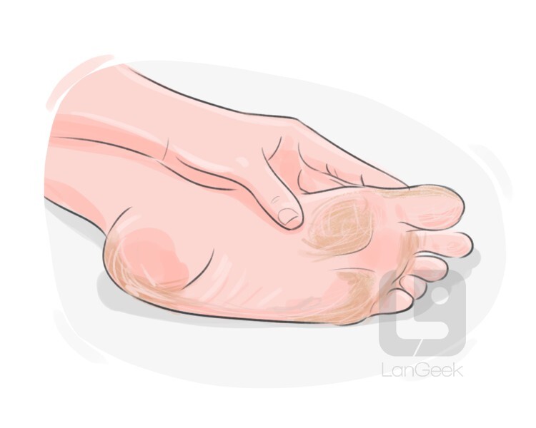 Definition & Meaning of "Callus" LanGeek