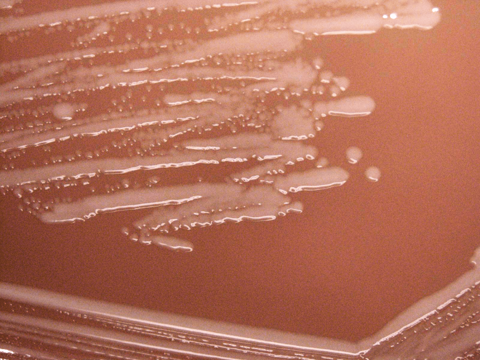 Haemophilus Concise Medical Knowledge