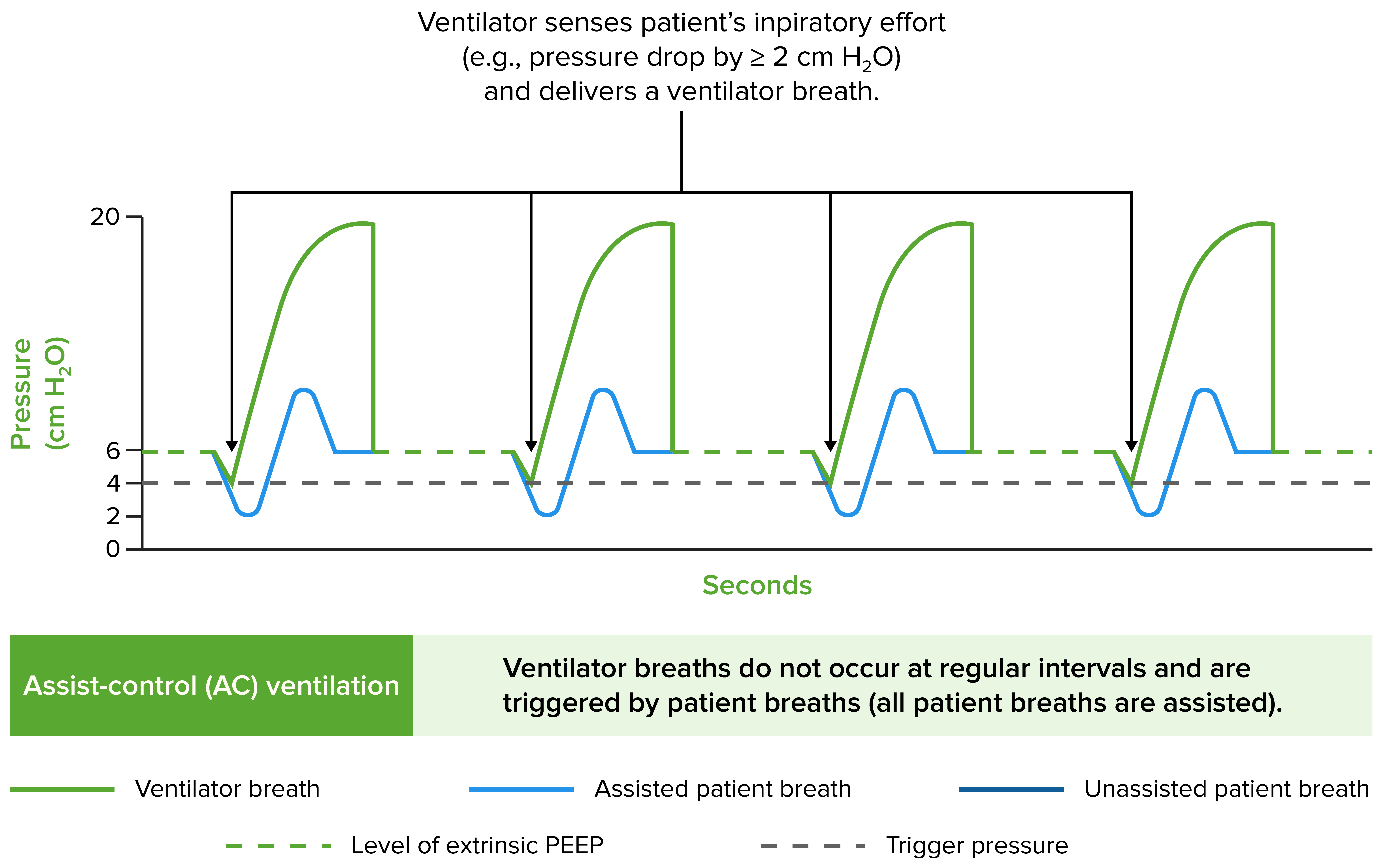 Invasive Mechanical Ventilation Concise Medical Knowledge