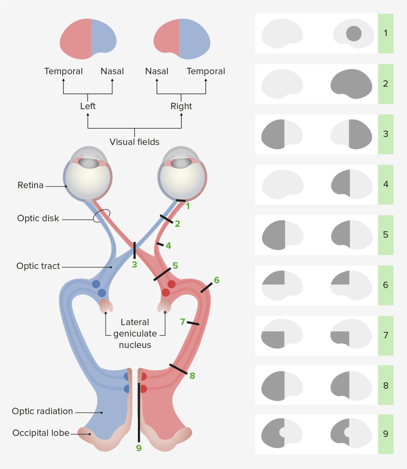 Visual Pathway & Visual Field Defects Lecturio Medical