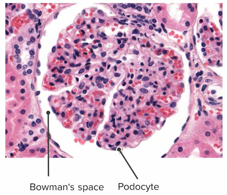 Glomerulonefritis Postinfecciosa Concise Medical Knowledge