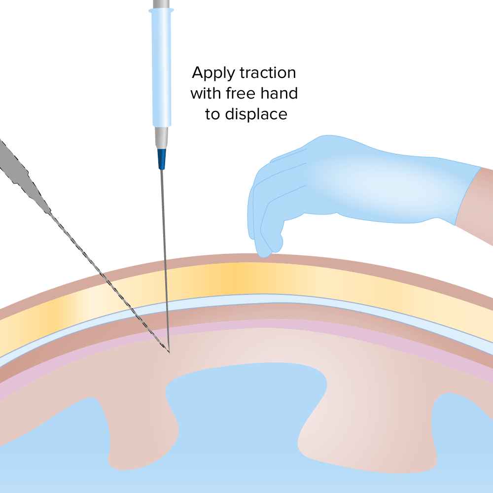 Procedimientos Básicos Concise Medical Knowledge