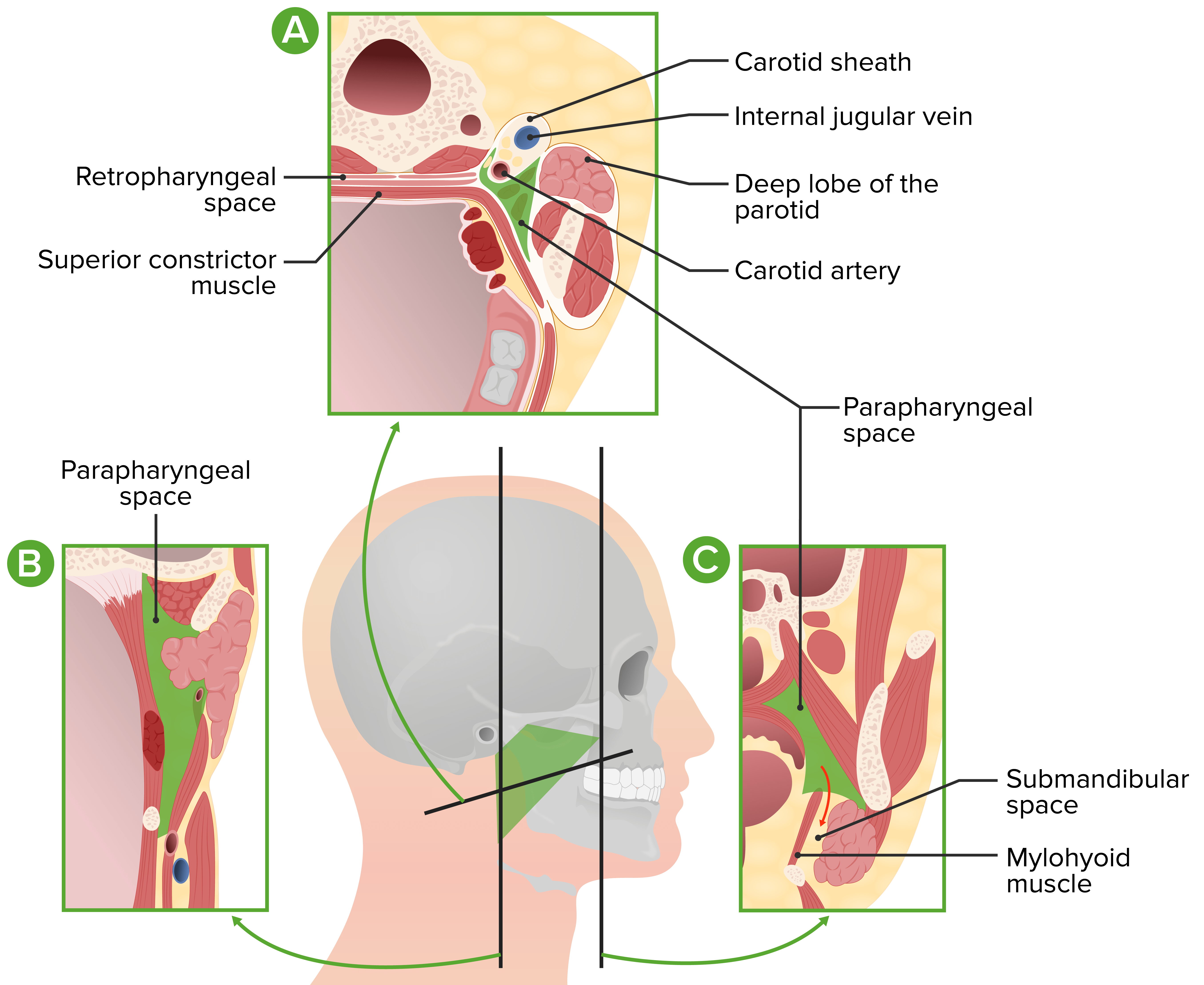 Absceso Parafaríngeo Concise Medical Knowledge