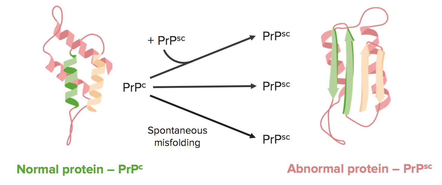 Transmissible Spongiform Encephalopathies Concise Medical Knowledge