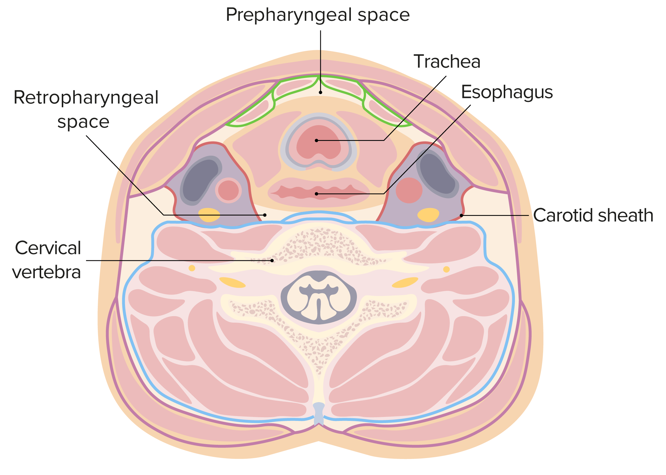 Retropharyngeal Abscess Concise Medical Knowledge