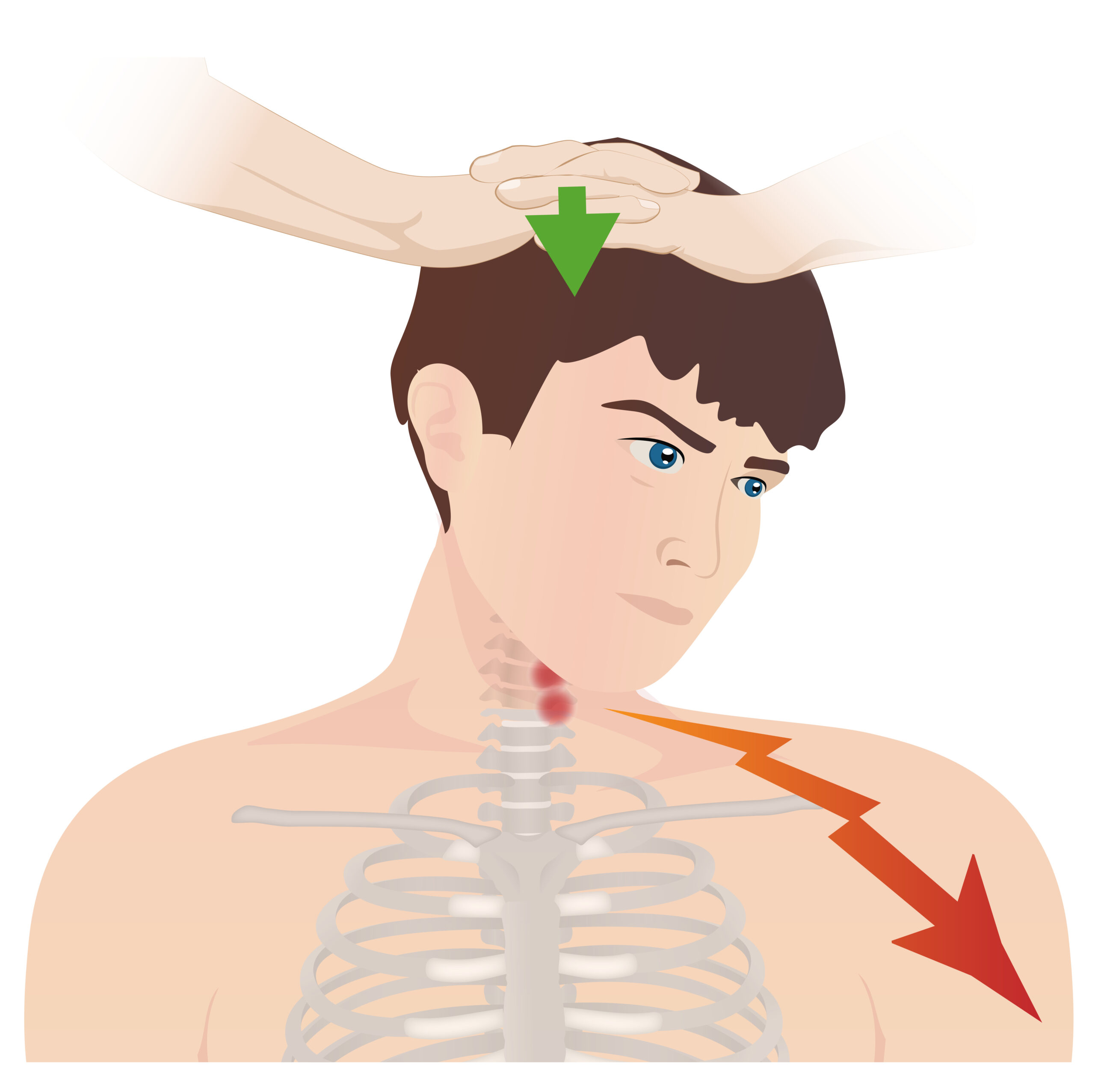 Neck Pain Concise Medical Knowledge