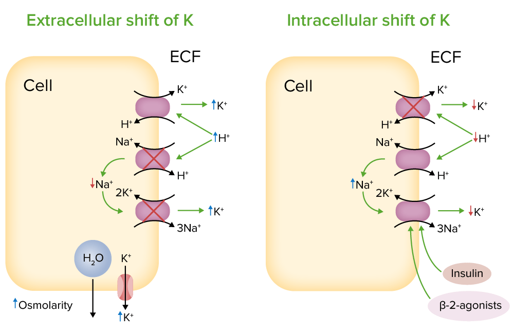 Hypokaliämie ELearning mit Lecturio
