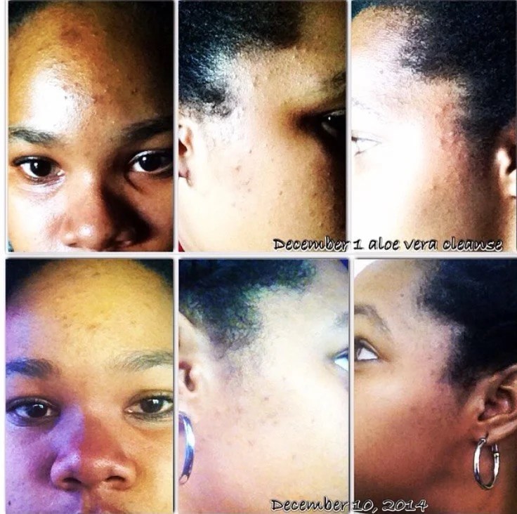 Is The Aloe Vera Plant Good For Your Face Plantă Blog