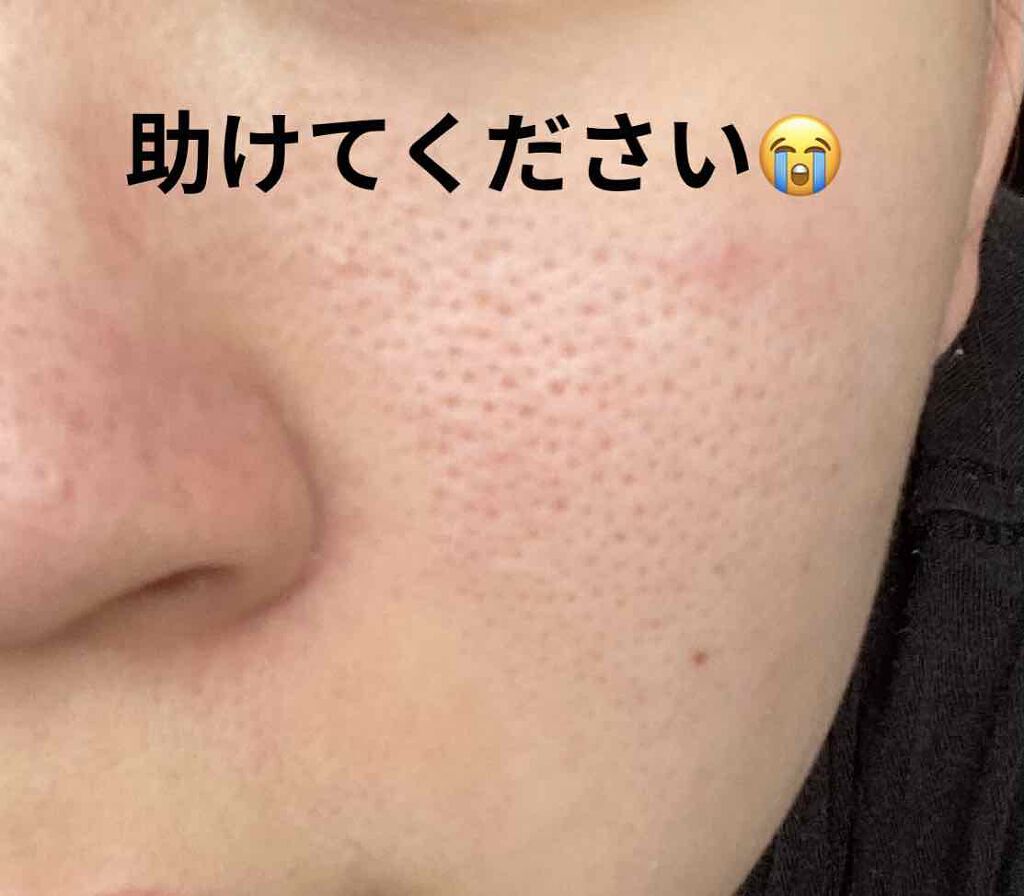 メンズの毛穴ケアおすすめ26選！人気化粧水で肌を引き締め - トラブルブック 開いた毛穴を閉じるには？Ng＆正しいケアを解説【おすすめの化粧水や美容液も紹介】 | Lips