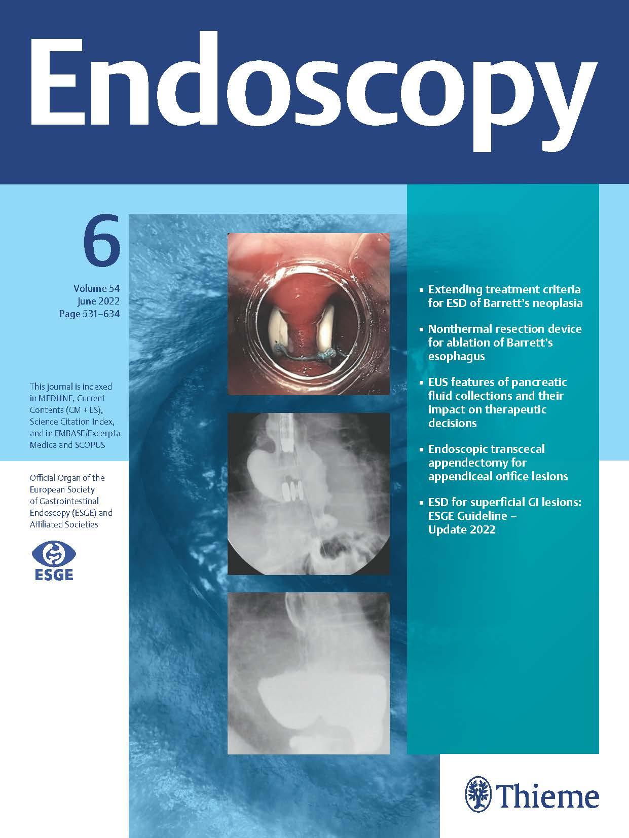 Endoscopy_Endoscopy期刊_Endoscopy杂志论论