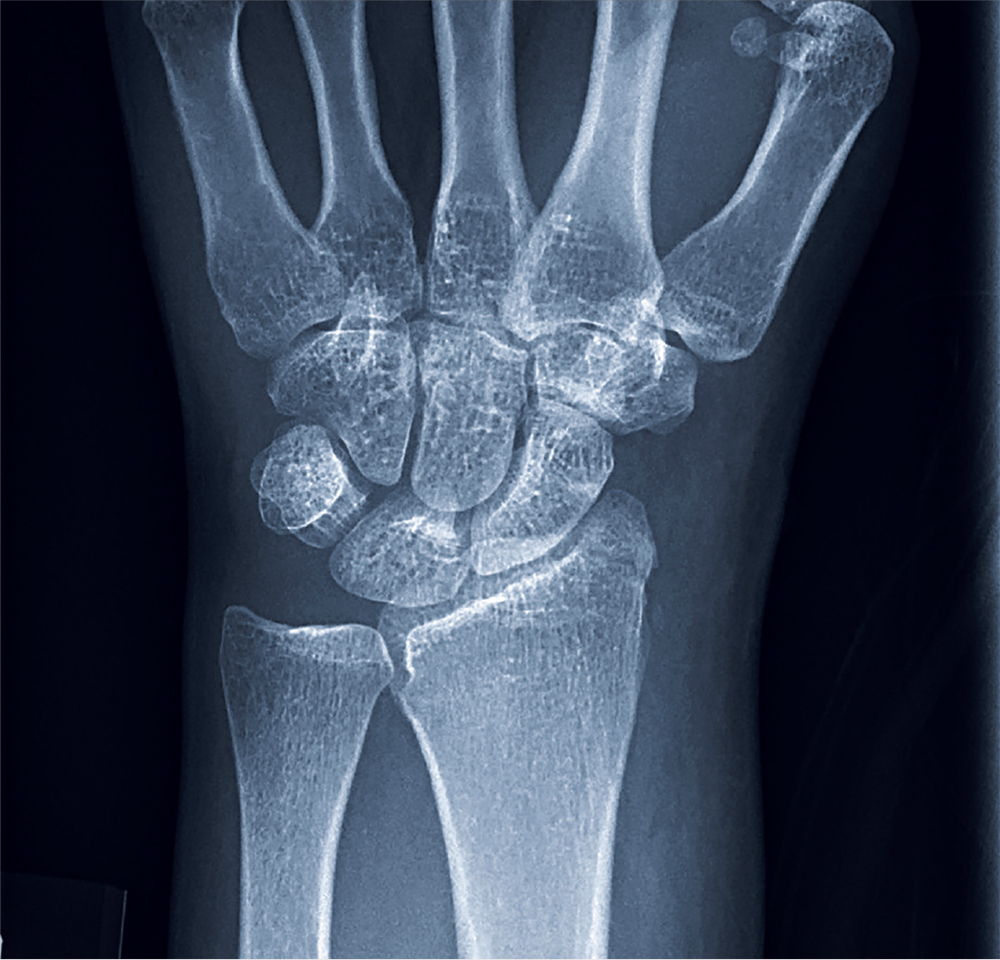 Brace for Impact Clinician Reviews