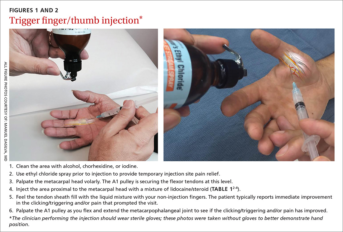 Hand and arm pain A pictorial guide to injections MDedge Family Medicine