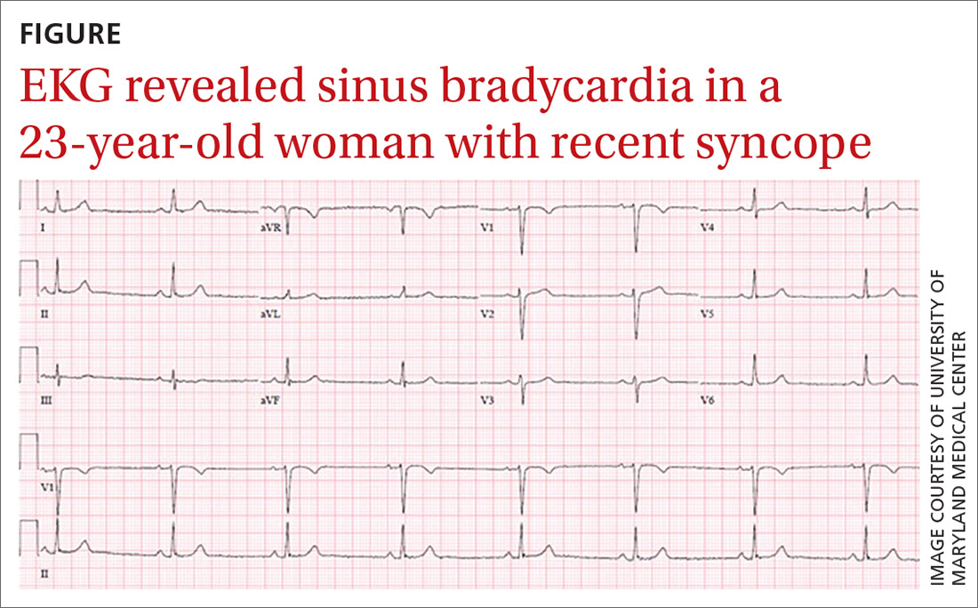 23yearold woman • syncopal episode • sinus bradycardia • history of