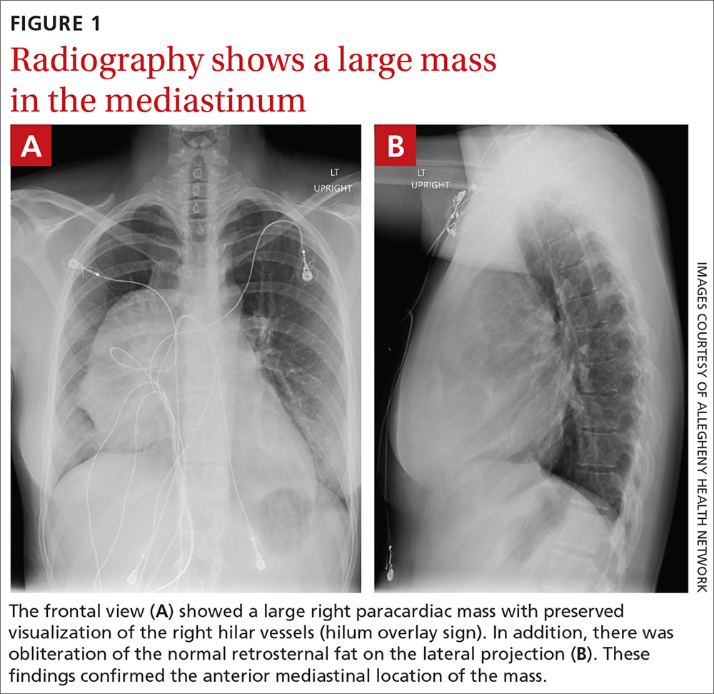 18yearold woman • chest pain • shortness of breath