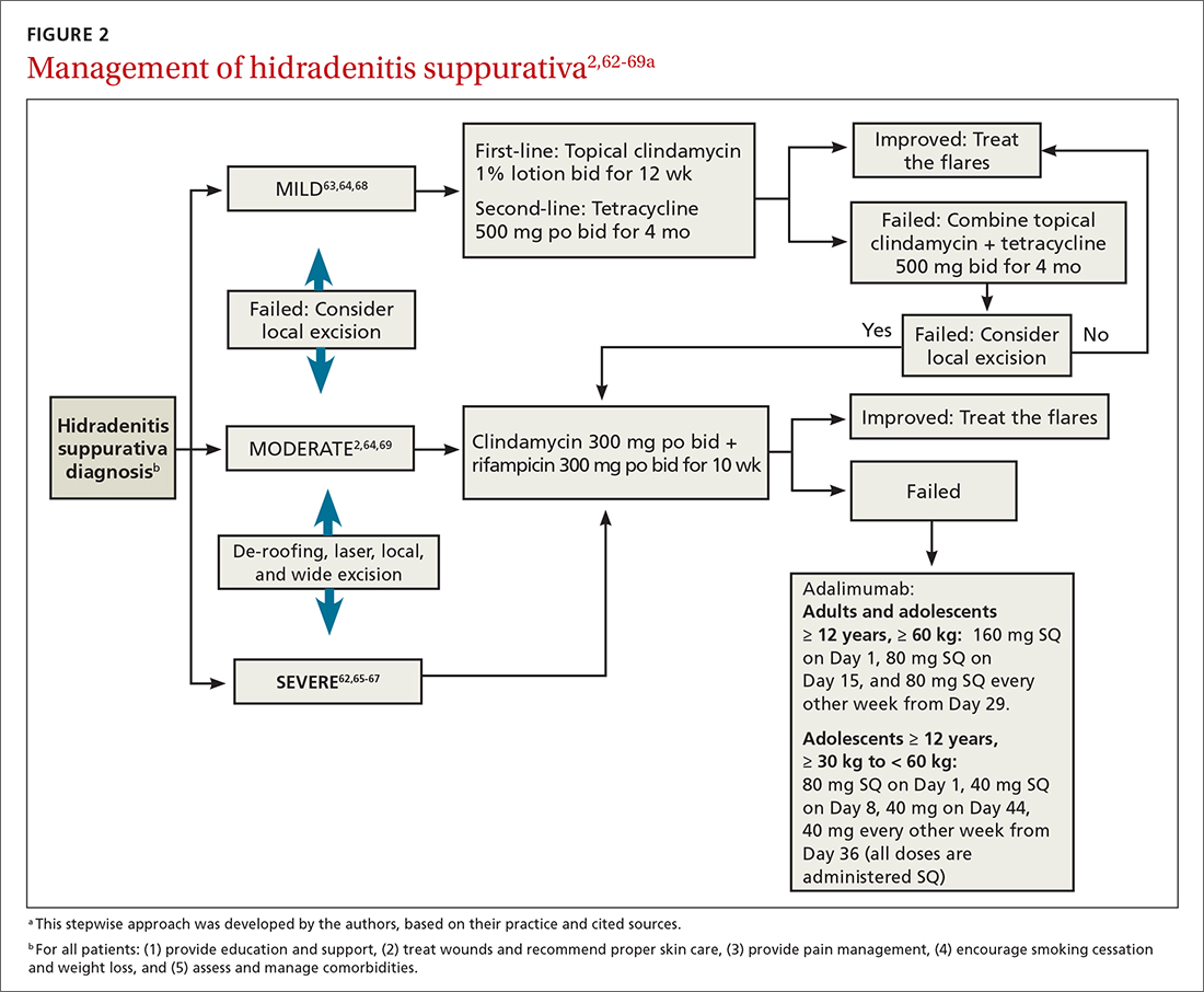 A practical guide to hidradenitis suppurativa MDedge Family Medicine