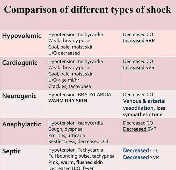 Comparison of different types of shock MEDizzy(04)