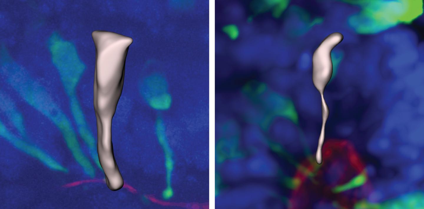 After 5 days, the gorilla neural progenitor cells matured into the spindle-like conical shape (right) but human cells (left) remained in a cylindrical shape.