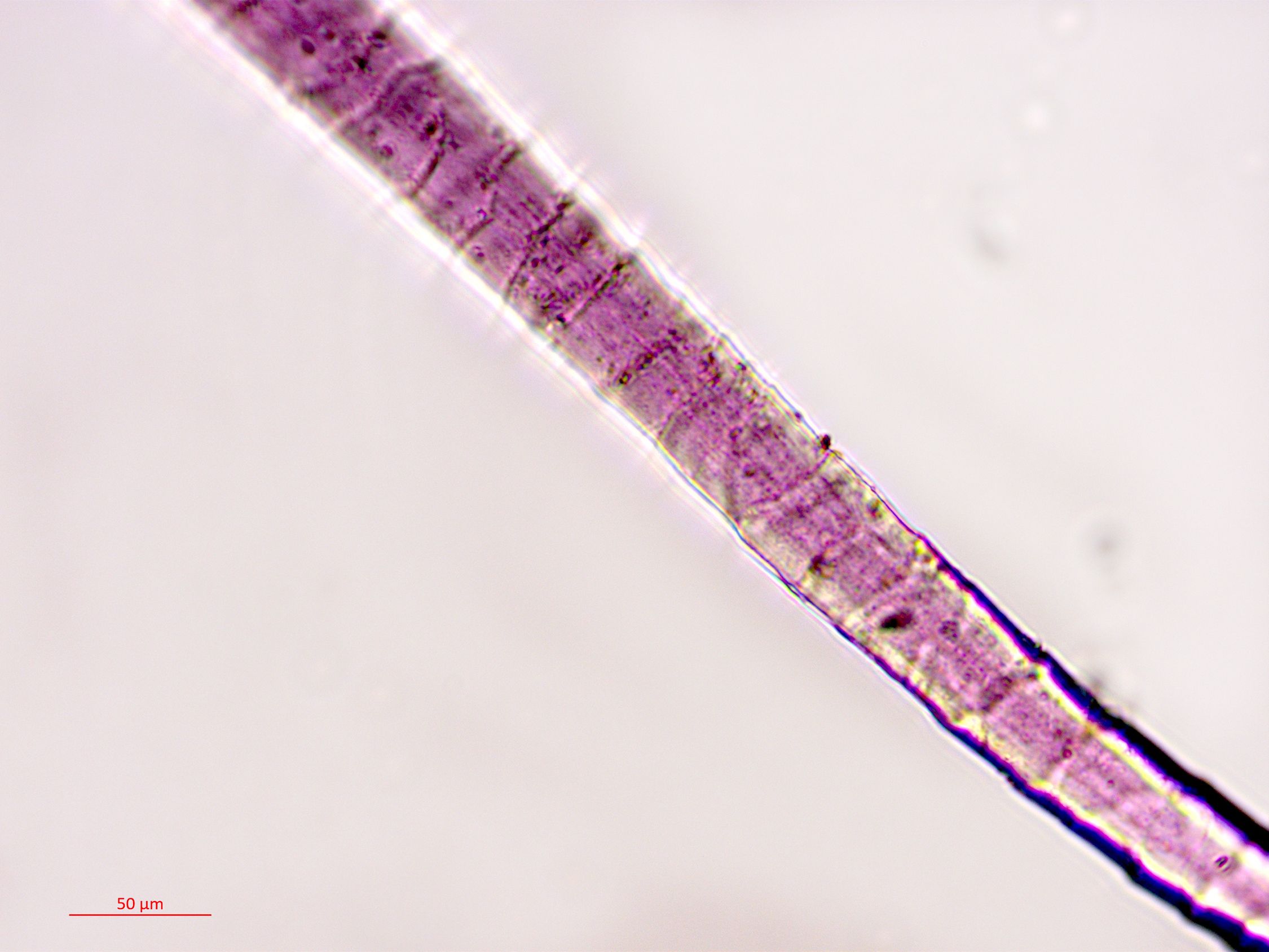 A single strand of dyed fabric photographed under a microscope.
