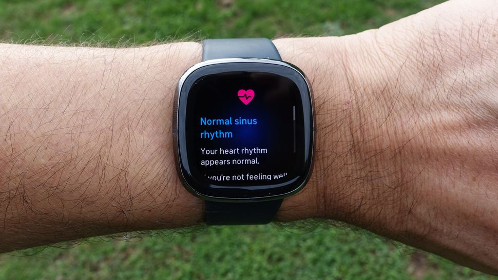 Apple Watch vs. Fitbit Which smartwatch brand should you buy? Tom's