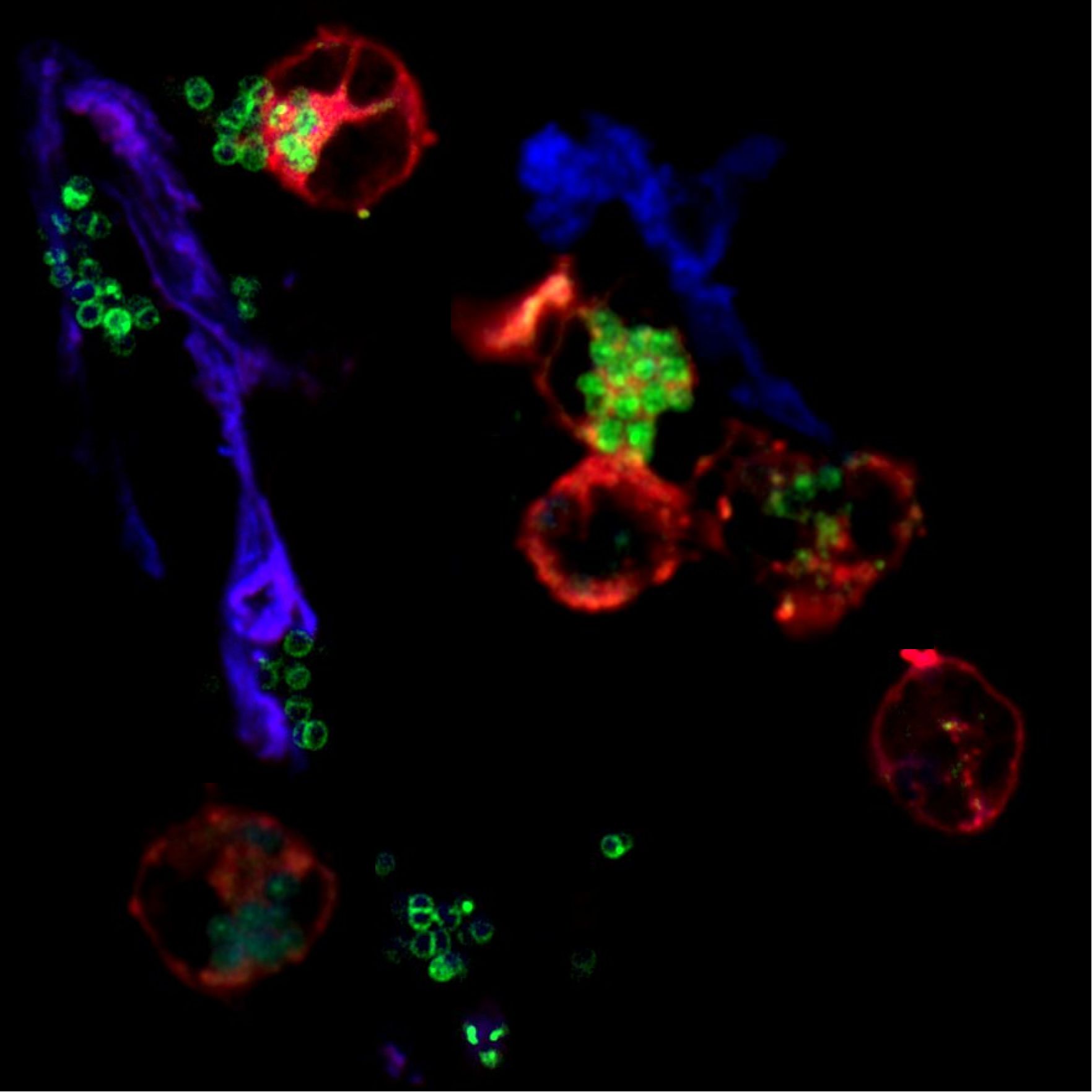 an image of neutrophils (red) cultured with S. aureus (green) and the formation of neutrophil extracellular traps (blue) in response
