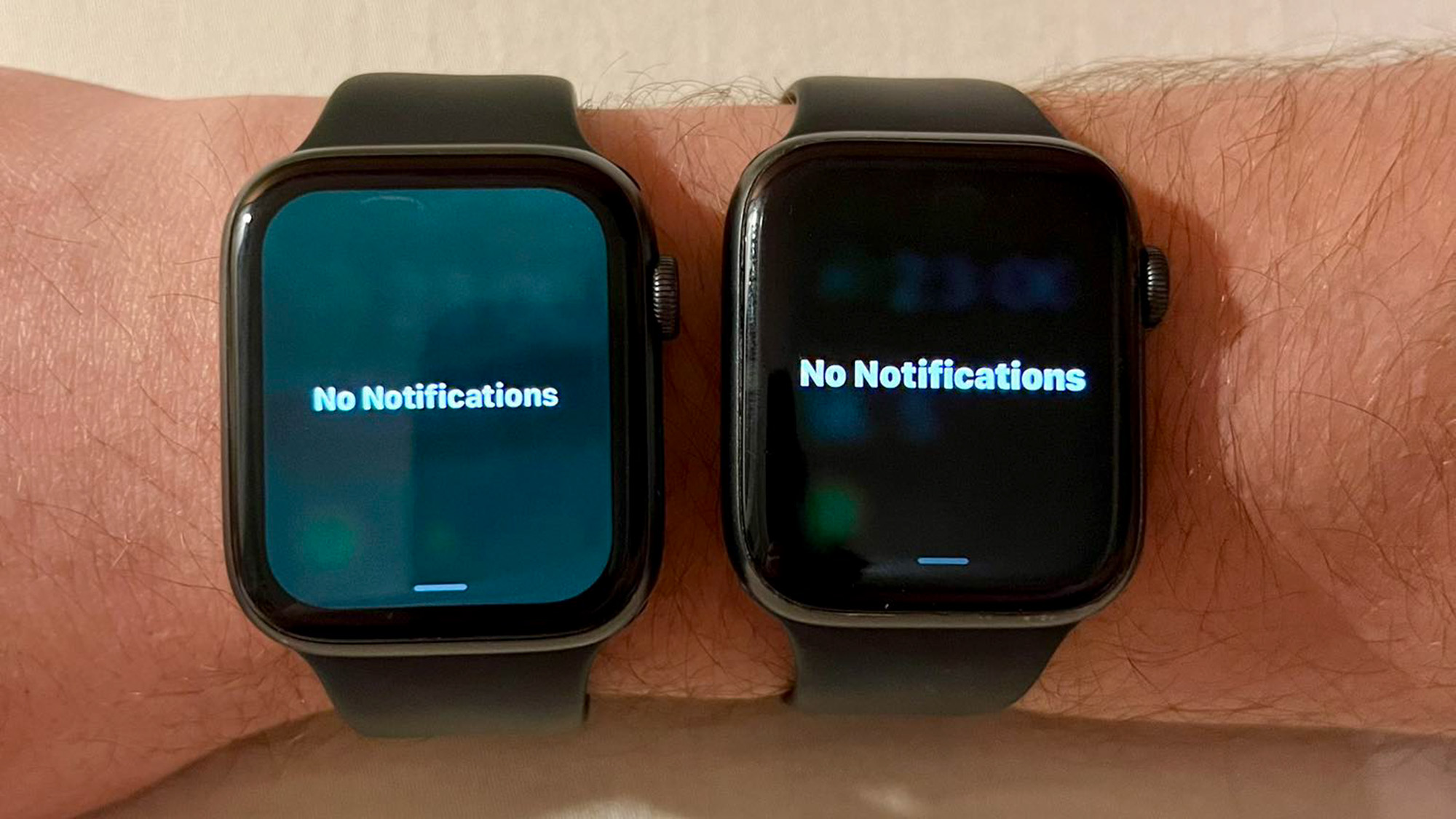 Some Apple Watch displays are turning green — is a fix coming? Laptop Mag