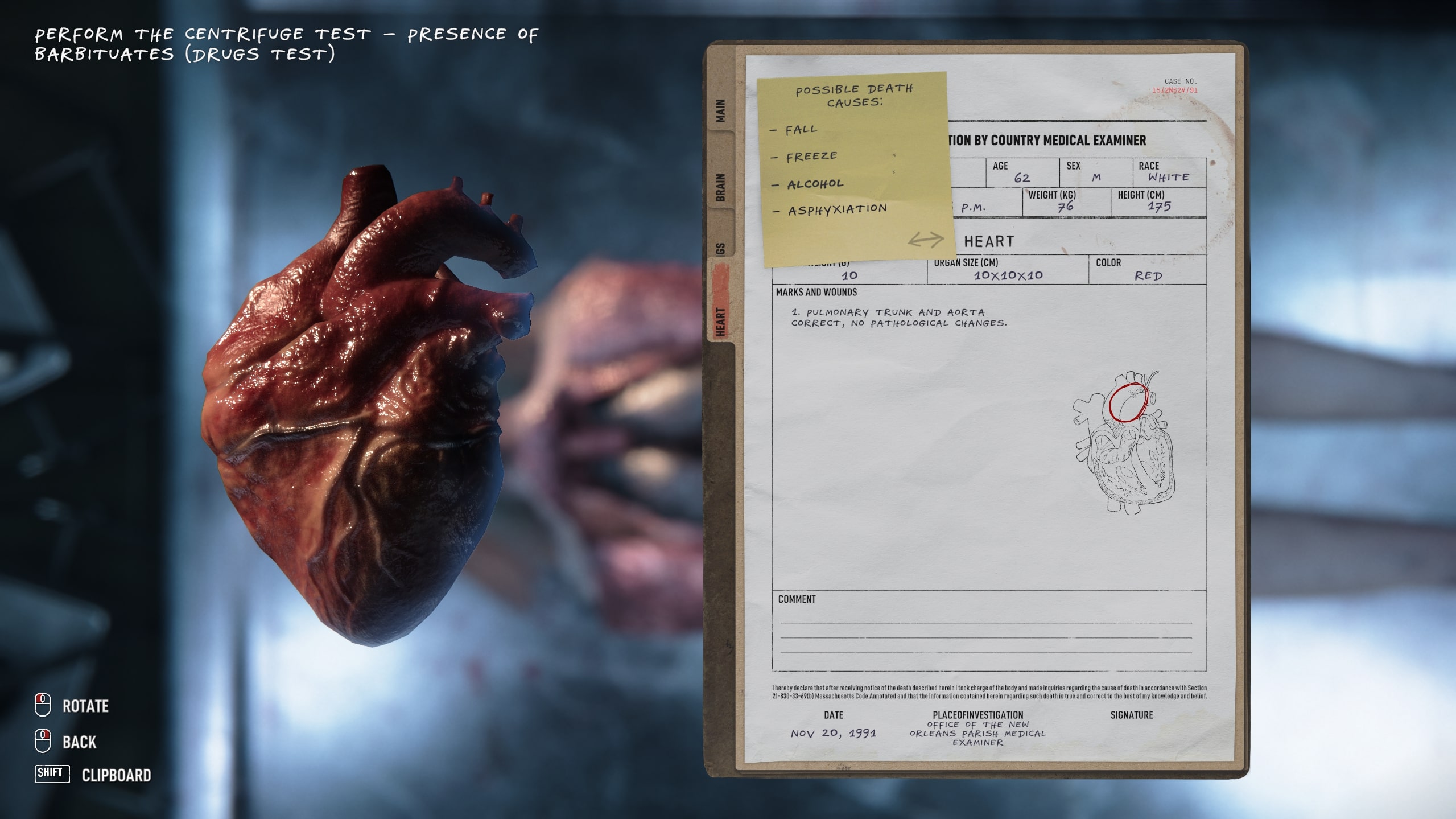 Autopsy Simulator Is One Of The Most Realistic Games