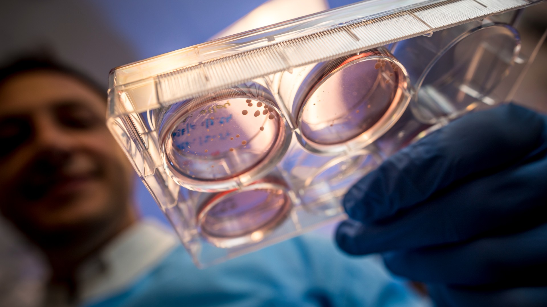 Close-up image of a petri dish containing lab-grown mini brains being held by a scientist wearing blue gloves. The scientist�s face can be seen blurred in the background