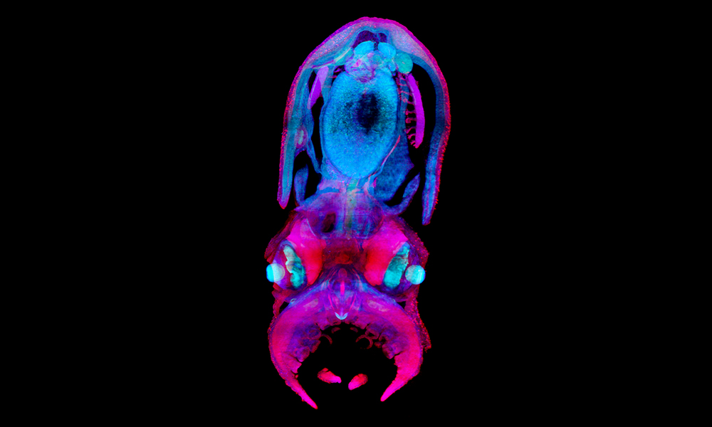 A 30-day-old octopus hatchling imaged using light-sheet microscopy.