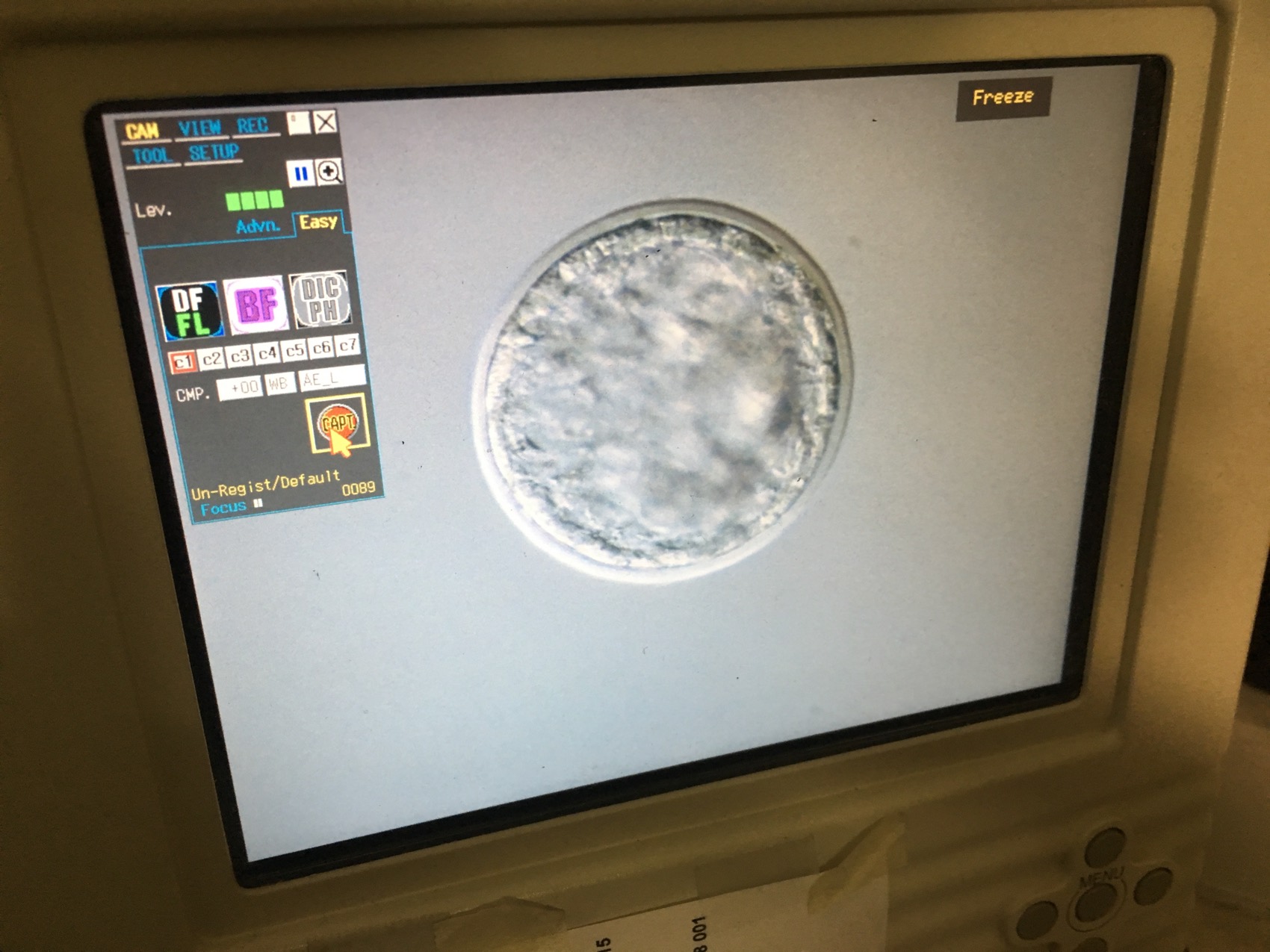 A fertilized embryo of a northern white rhino.