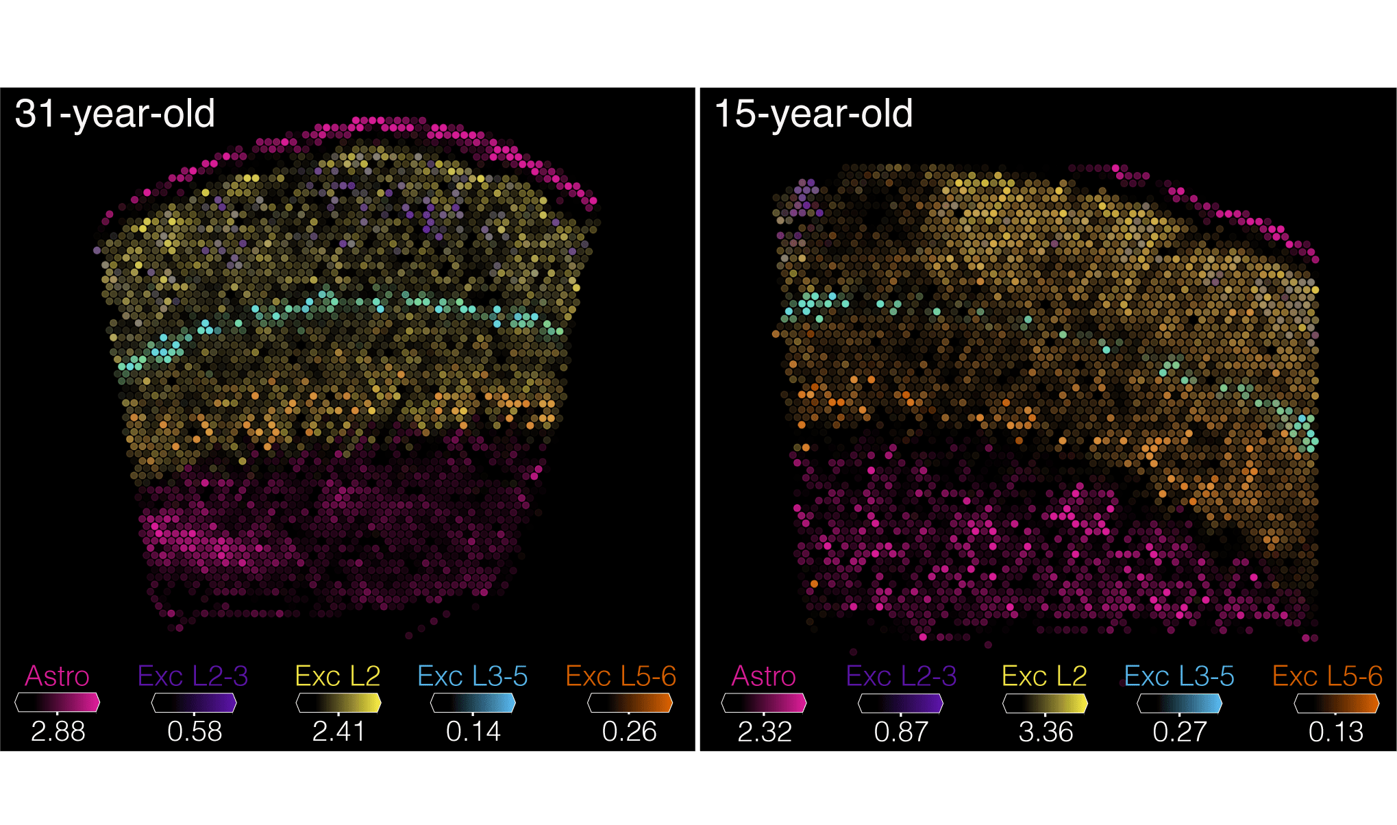 two images showing brain tissue with different types of cells labeled with different colors