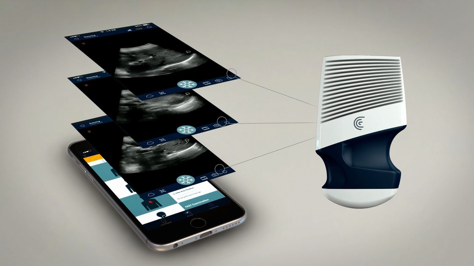 This portable ultrasound will beam images straight to your phone