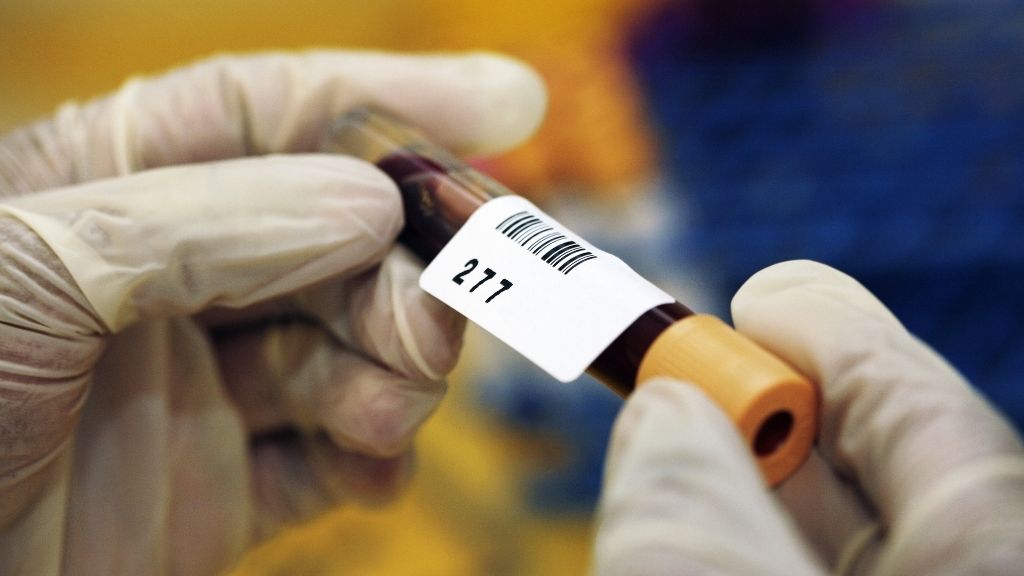 close up of a pathologist�s hands as they label a test tube containing a blood sample