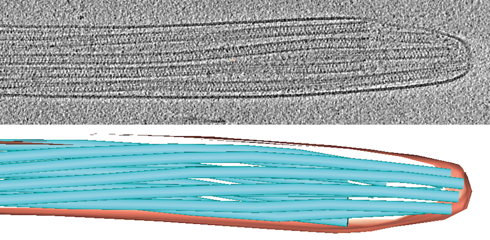 Researchers found the mysterious structure in the sperm tails by using cryo-electron tomography.