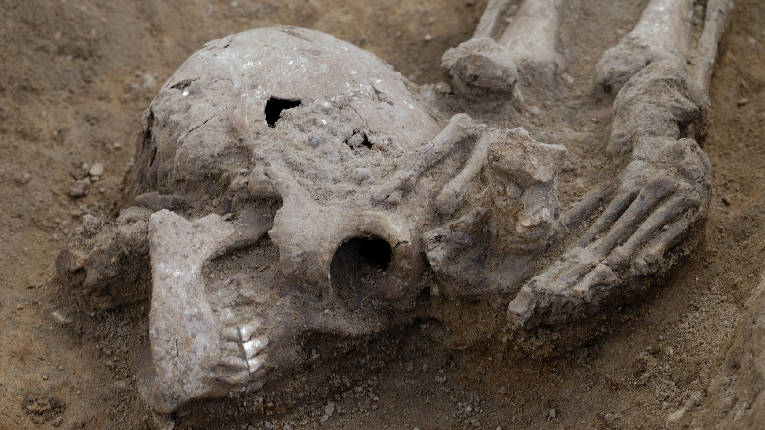 Many of the decapitated skeletons had their heads buried like the one shown here.