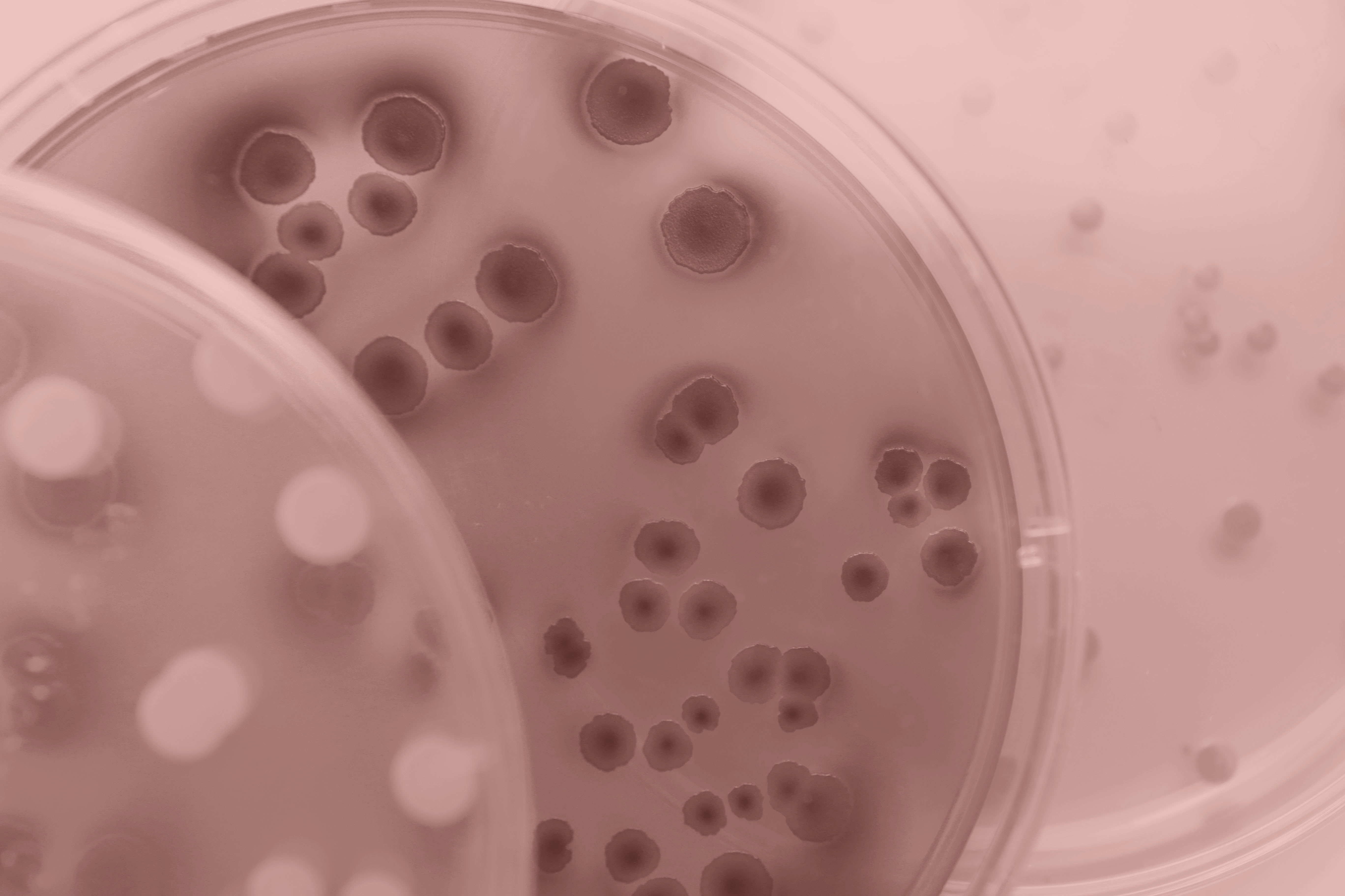 Three overlapping petri dishes with bacterial growth