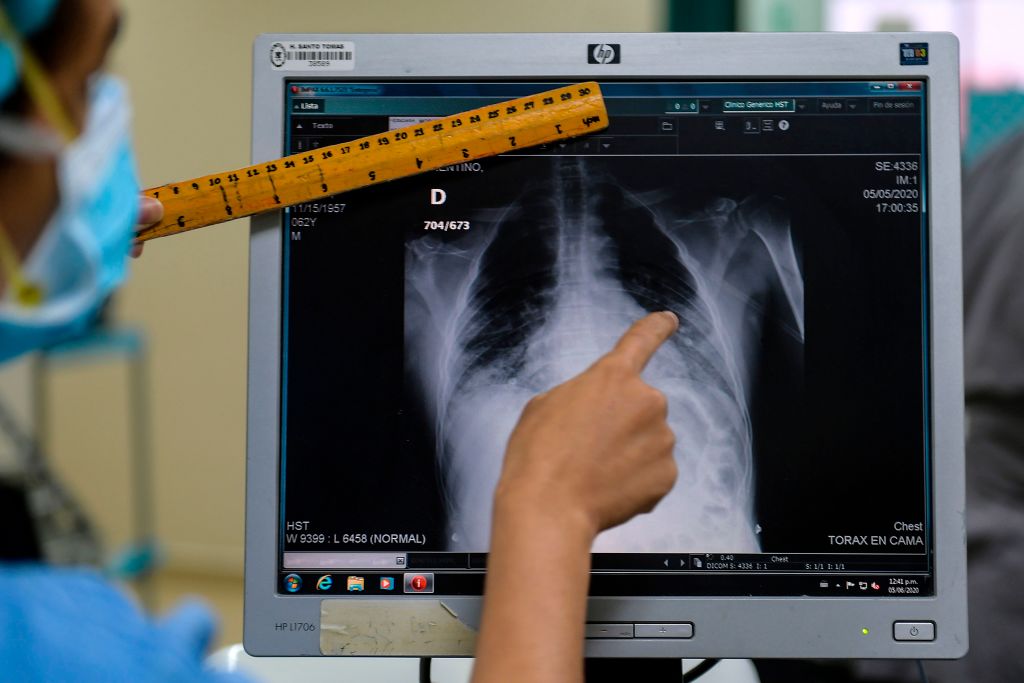 Chest X Ray Cost Sydney at Laurie Witten blog
