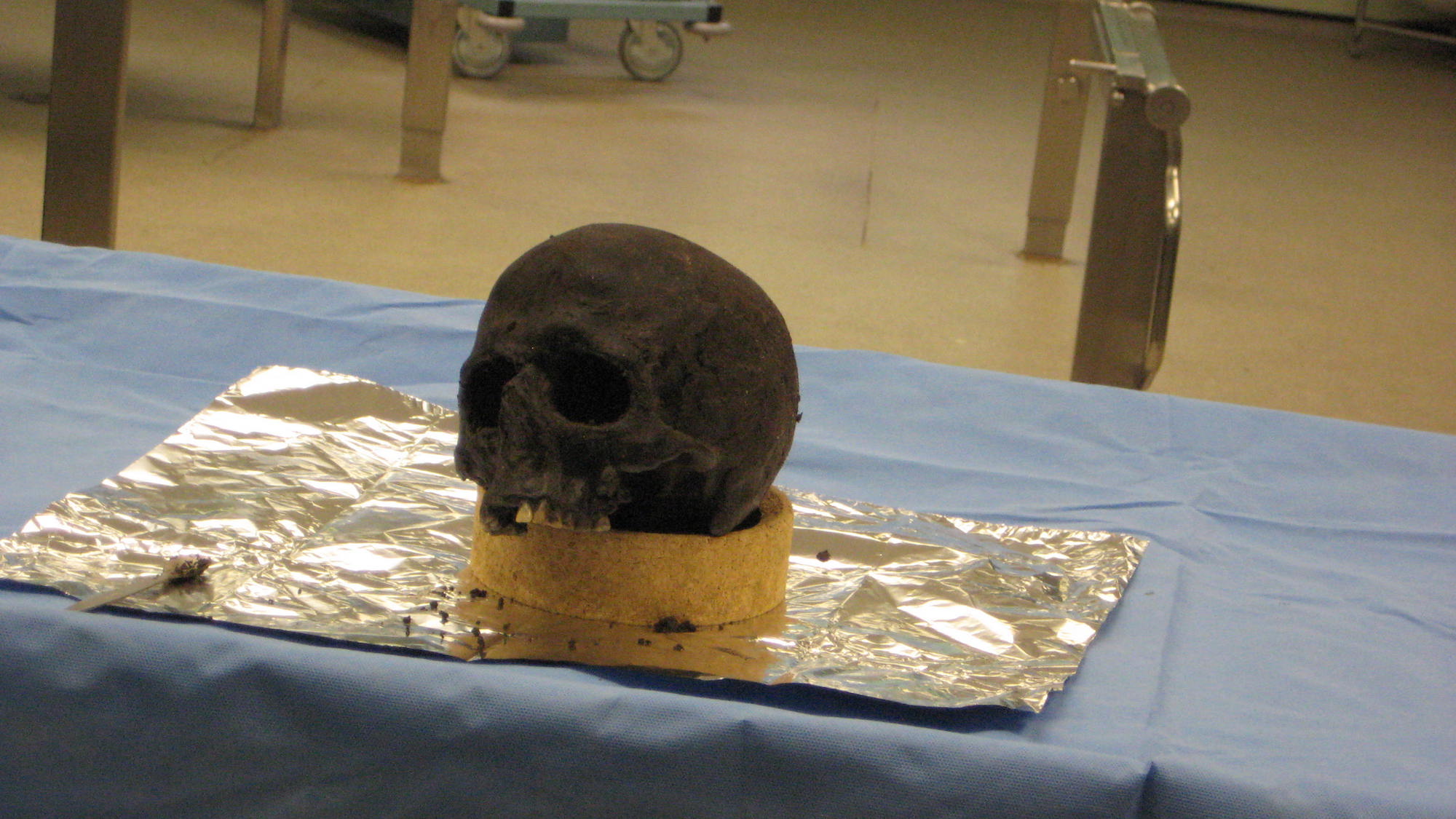 The Heslington skull retains a few teeth, as well as its brain.