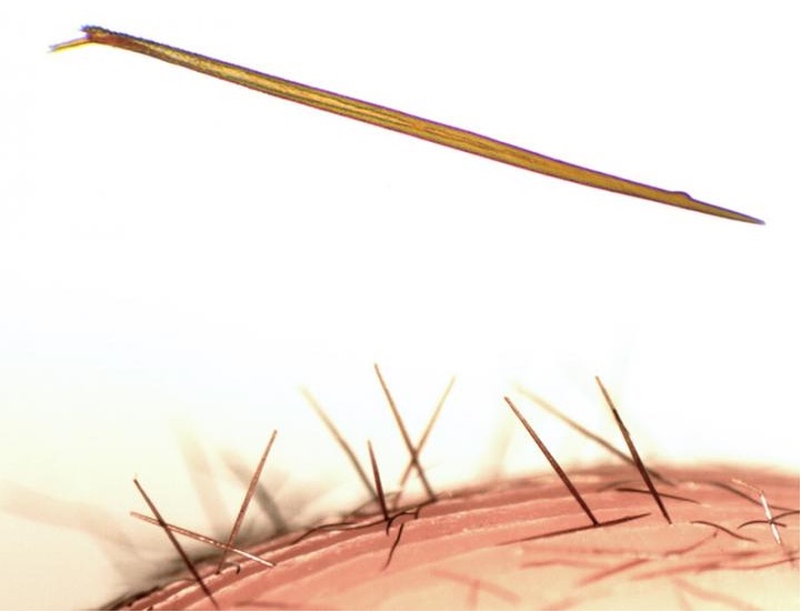 A close-up of the hairs on the newfound tarantula Kankuamo marquezi.