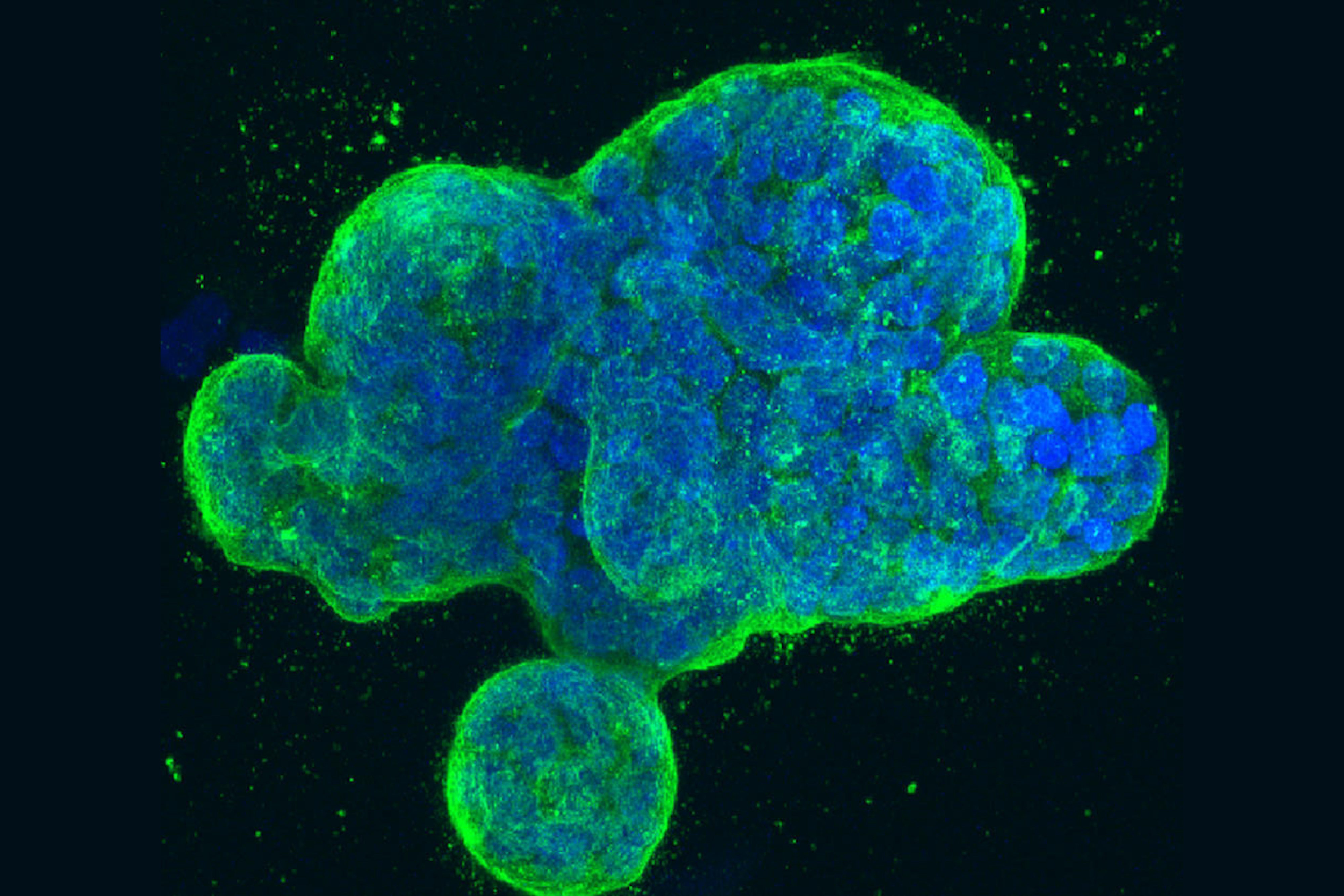 Green blobs containing smaller blue blobs, against a black background.