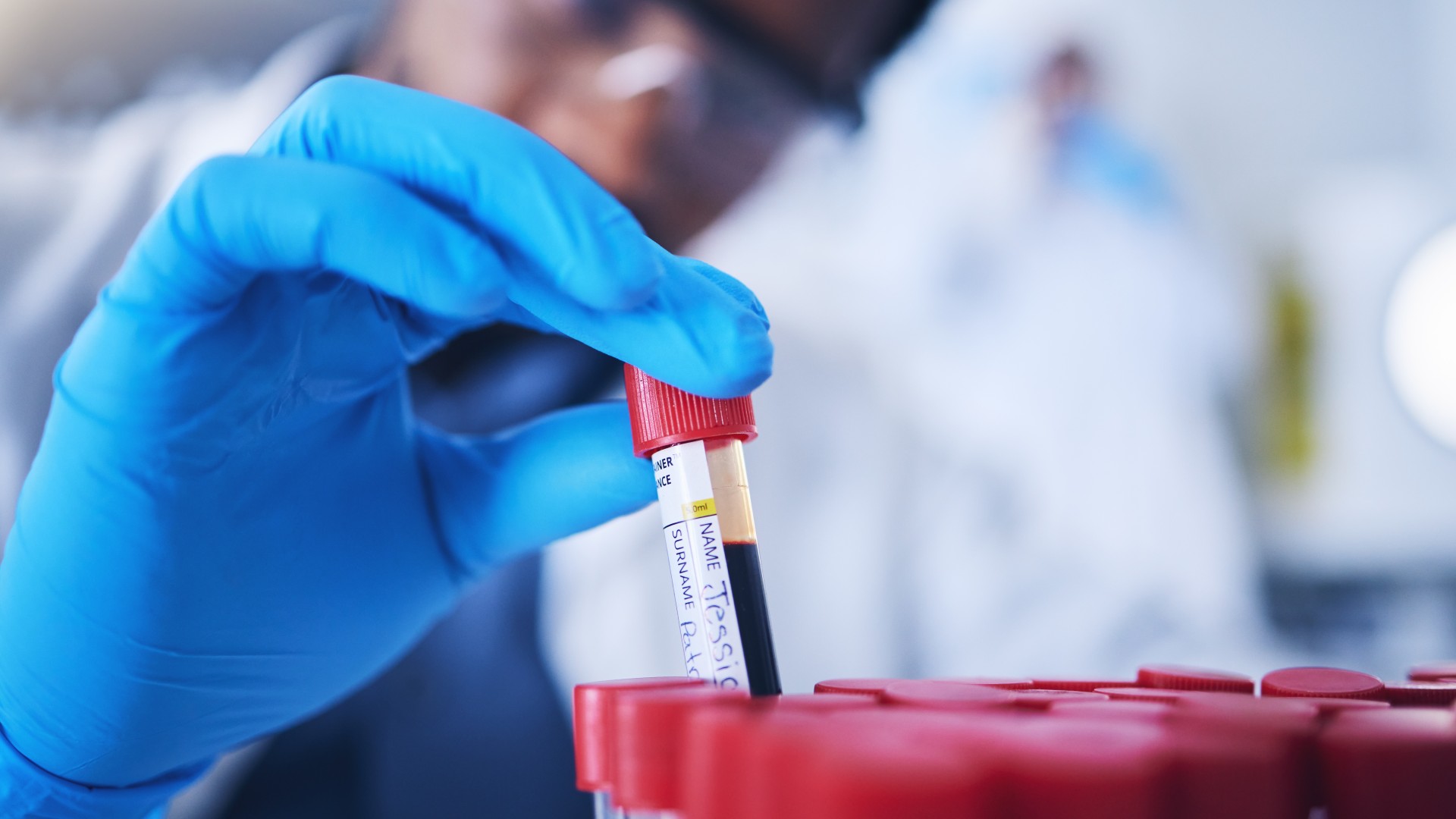 Close-up of a scientist picking up a test tube with a red lid containing blood. The scientists� hand is in focus and they are wearing blue gloves. The test tube is picked up from amongst what looks like a group of tubes, where the red tops are only visible. The scientists blurred face is shown in the background. They are wearing goggles.
