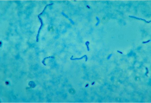 An image of <em>Fusobacterium necrophorum<em> a type of bacteria that is the most common cause of Lemierre syndrome, a rare infection that�s been dubbed a "forgotten disease."