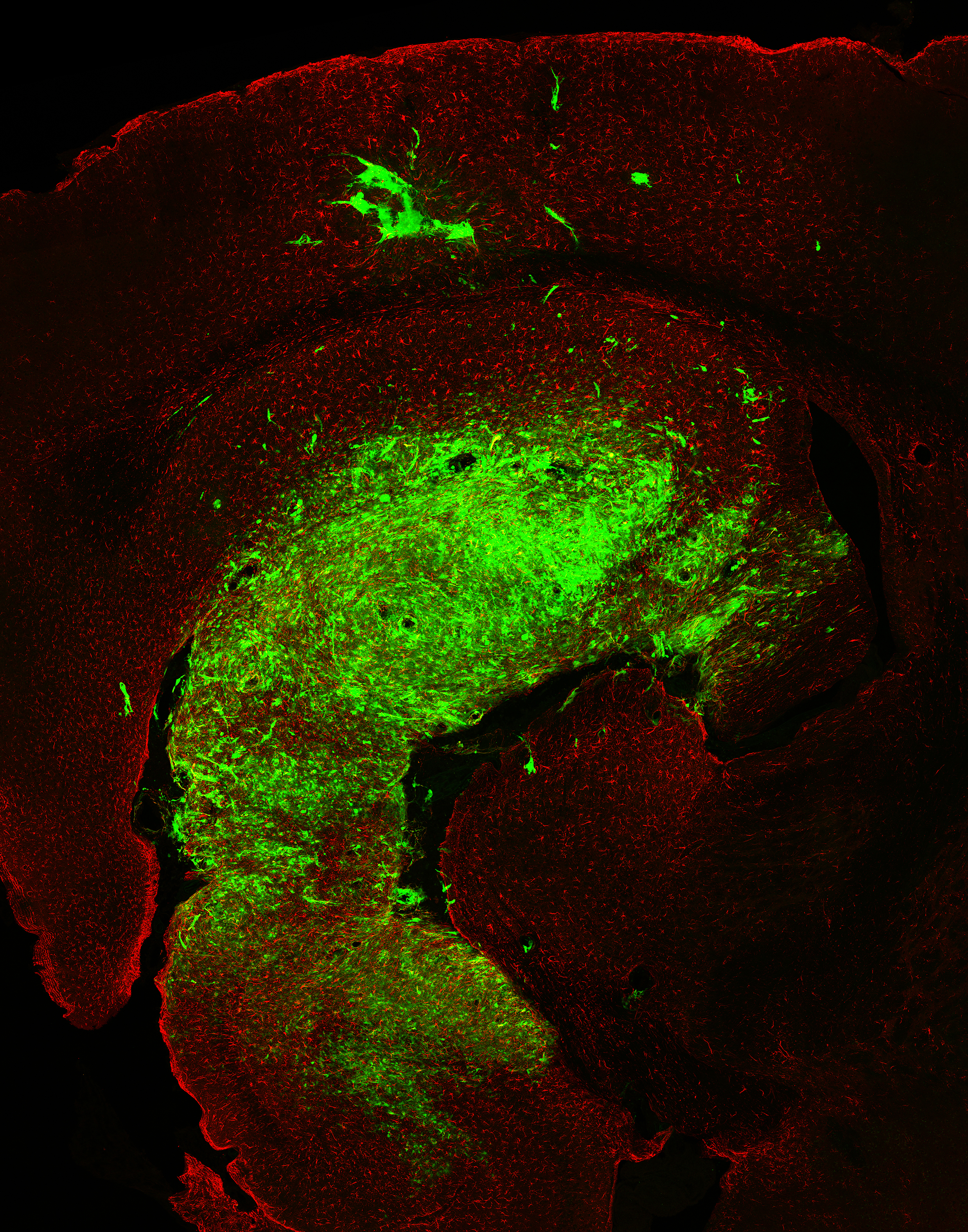 cancer in a mouse